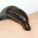 Understanding Jalaukavacharana: The Therapeutic Science Behind Leech Therapy in Ayurveda