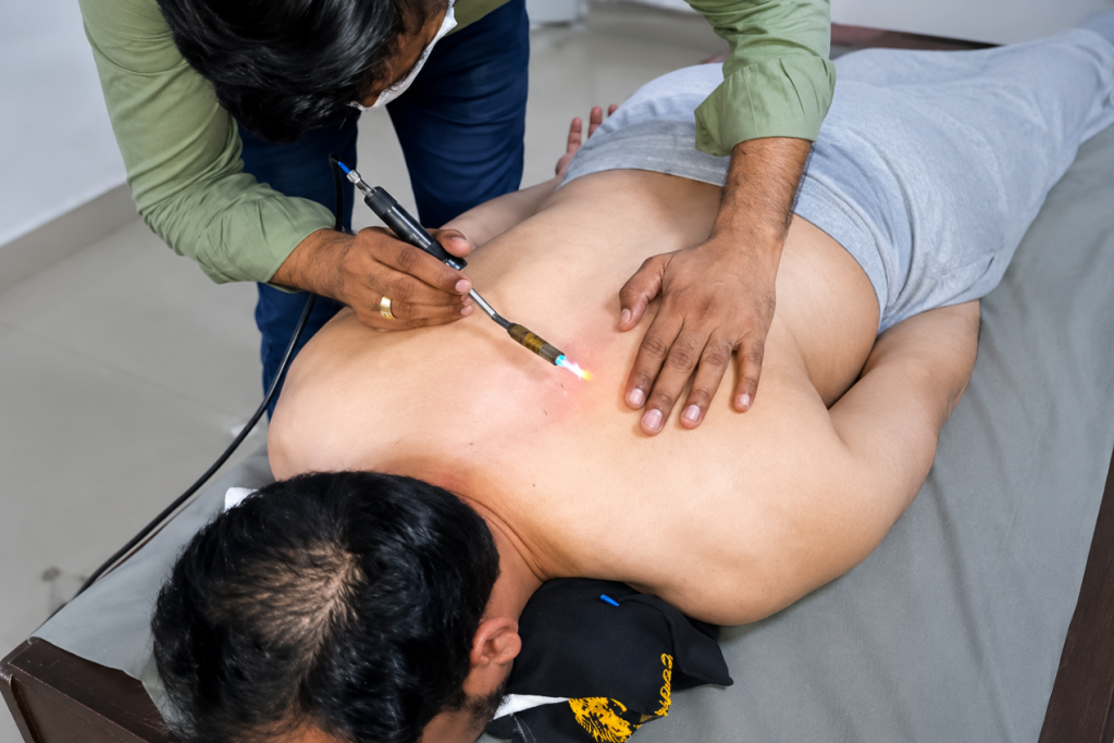 Exploring the Ancient Art of Healing: Hot Needle Therapy (Agnikarma)