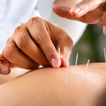 Understanding Agnikarma Therapy: Pain Management Insights from Dr. Manish Yadav